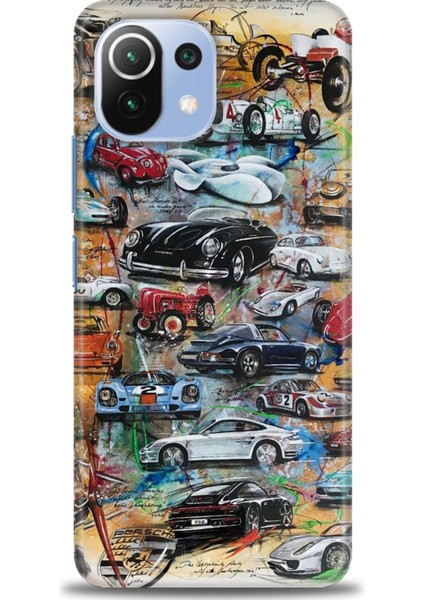 Xiaomi Mi 11 Lite Kılıf Hd Baskılı Kılıf + Seramik Tam Kaplayan Ekran Koruyucu 483