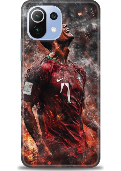 Xiaomi Mi 11 Lite Kılıf Hd Baskılı Kılıf + Seramik Tam Kaplayan Ekran Koruyucu 8