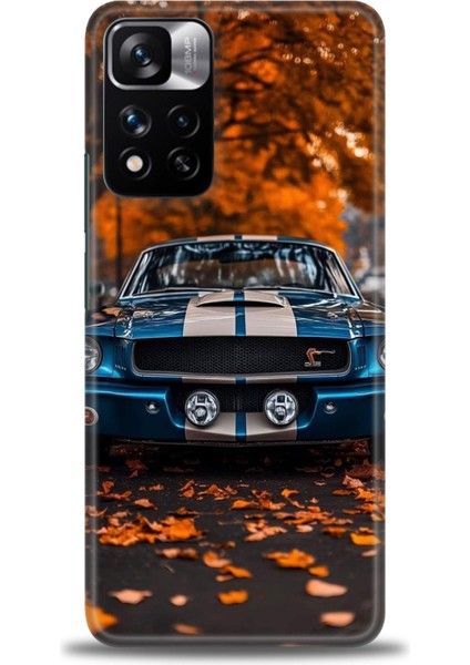 Xiaomi Redmi Note 11 Pro Plus Hd Baskılı Kılıf + Seramik Tam Kaplayan Ekran Koruyucu 103