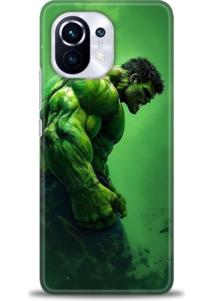 Xiaomi Mi 11 Kılıf Hd Baskılı Kılıf + Seramik Tam Kaplayan Ekran Koruyucu 96