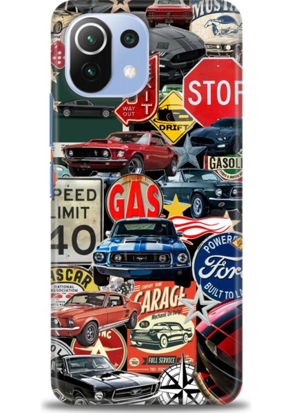 Xiaomi Mi 11 Lite Kılıf Hd Baskılı Kılıf + Seramik Tam Kaplayan Ekran Koruyucu 482