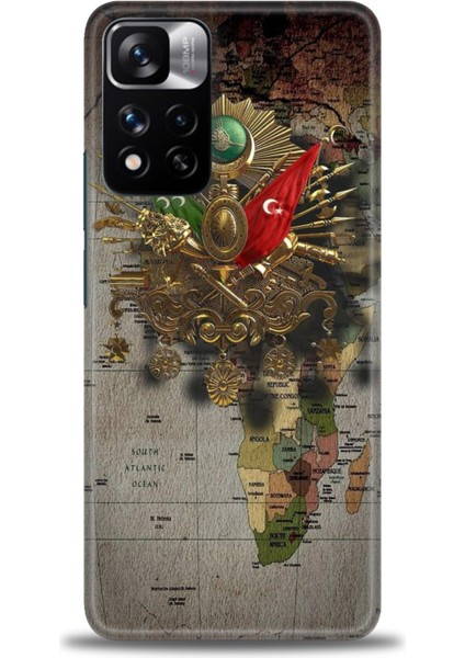 Xiaomi Redmi Note 11 Pro Plus Hd Baskılı Kılıf + Seramik Tam Kaplayan Ekran Koruyucu 467