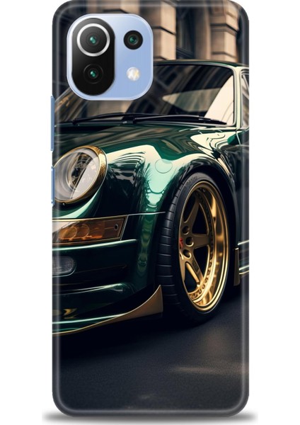 Xiaomi Mi 11 Lite Kılıf Hd Baskılı Kılıf + Seramik Tam Kaplayan Ekran Koruyucu 486