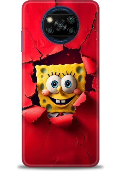 Xiaomi Poco X3 Pro Kılıf Hd Baskılı Kılıf + Seramik Tam Kaplayan Ekran Koruyucu 458
