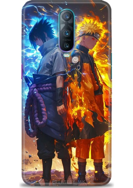 Oppo RX17 Pro Kılıf Hd Baskılı Kılıf + Seramik Tam Kaplayan Ekran Koruyucu 260