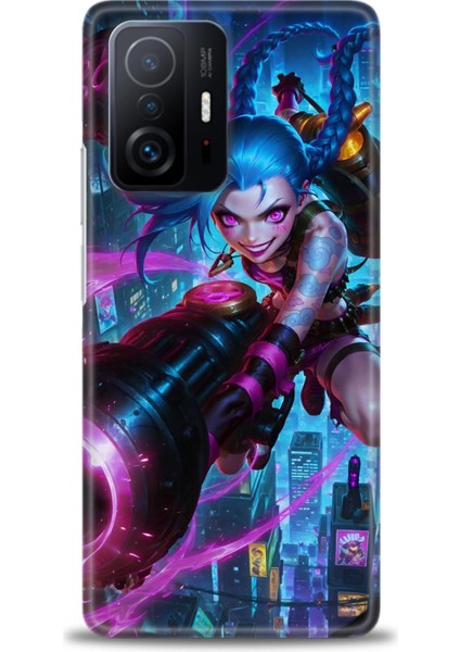 Xiaomi Mi 11T Kılıf Hd Baskılı Kılıf + Seramik Tam Kaplayan Ekran Koruyucu 280