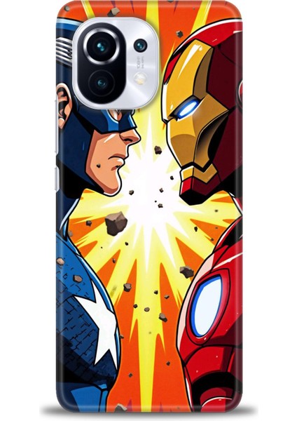 Xiaomi Mi 11 Kılıf Hd Baskılı Kılıf + Seramik Tam Kaplayan Ekran Koruyucu 93