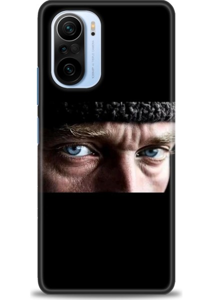 Xiaomi Mi 11I Kılıf Hd Baskılı Kılıf + Seramik Tam Kaplayan Ekran Koruyucu 28