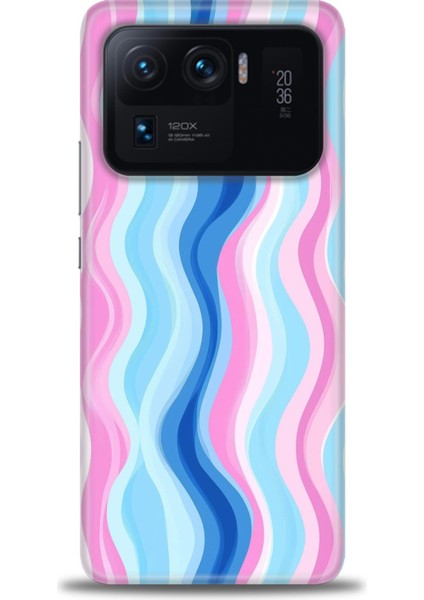 Xiaomi Mi 11 Ultra Kılıf Hd Baskılı Kılıf + Seramik Tam Kaplayan Ekran Koruyucu 429