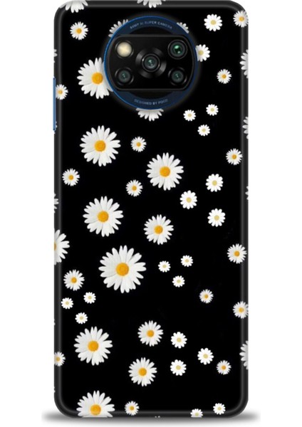 Xiaomi Poco X3 Pro Kılıf Hd Baskılı Kılıf + Seramik Tam Kaplayan Ekran Koruyucu 131