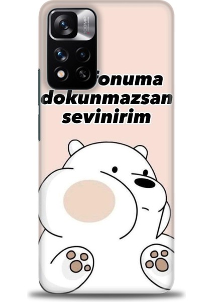 Xiaomi Redmi Note 11 Pro Plus Hd Baskılı Kılıf + Seramik Tam Kaplayan Ekran Koruyucu 158