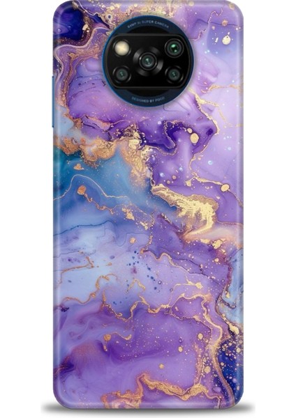 Xiaomi Poco X3 Nfc Kılıf Hd Baskılı Kılıf + Seramik Tam Kaplayan Ekran Koruyucu 311