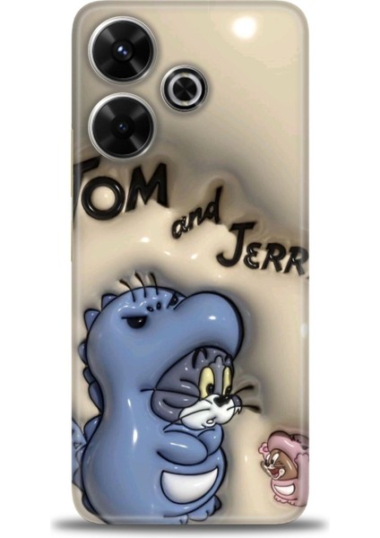 Xiaomi Redmi 13 4g Kılıf Hd Baskılı Kılıf + Seramik Tam Kaplayan Ekran Koruyucu 117