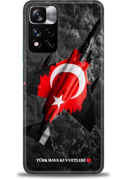 Xiaomi Redmi Note 11 Pro Plus Hd Baskılı Kılıf + Seramik Tam Kaplayan Ekran Koruyucu 37