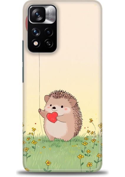 Xiaomi Redmi Note 11 Pro Plus Hd Baskılı Kılıf + Seramik Tam Kaplayan Ekran Koruyucu 305