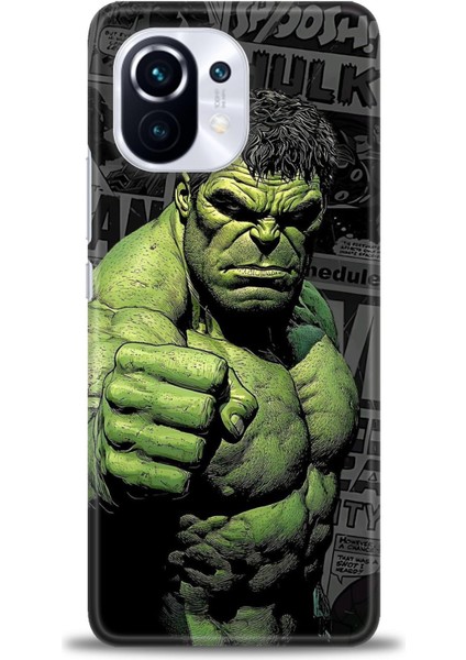 Xiaomi Mi 11 Kılıf Hd Baskılı Kılıf + Seramik Tam Kaplayan Ekran Koruyucu 97