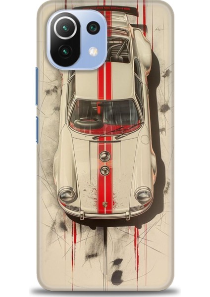 Xiaomi Mi 11 Lite Kılıf Hd Baskılı Kılıf + Seramik Tam Kaplayan Ekran Koruyucu 485