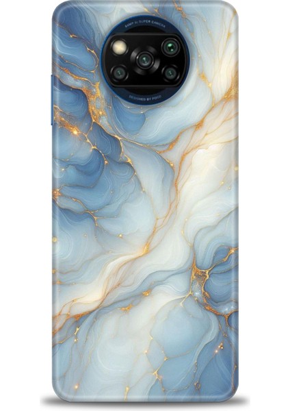 Xiaomi Poco X3 Nfc Kılıf Hd Baskılı Kılıf + Seramik Tam Kaplayan Ekran Koruyucu 318