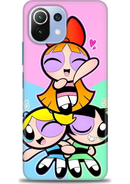 Xiaomi Mi 11 Lite Kılıf Hd Baskılı Kılıf + Seramik Tam Kaplayan Ekran Koruyucu 130