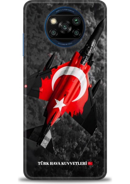 Xiaomi Poco X3 Pro Kılıf Hd Baskılı Kılıf + Seramik Tam Kaplayan Ekran Koruyucu 37