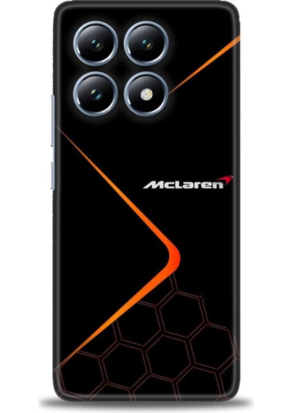 Xiaomi Mi 14T Kılıf Hd Baskılı Kılıf + Seramik Tam Kaplayan Ekran Koruyucu 379