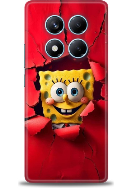 Xiaomi Redmi Note 14 Pro 4g Hd Baskılı Kılıf + Seramik Tam Kaplayan Ekran Koruyucu 458