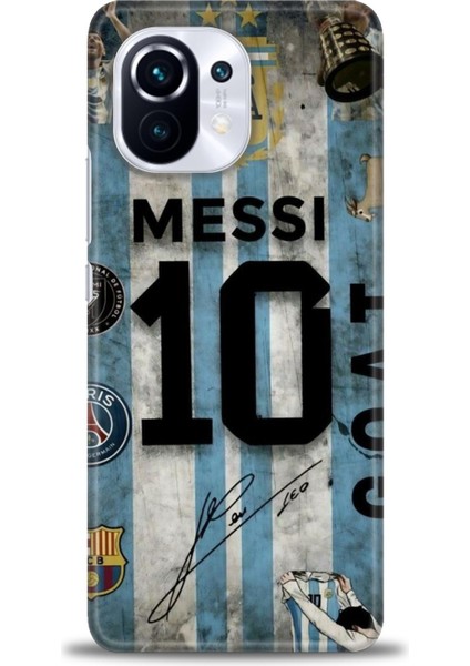 Xiaomi Mi 11 Kılıf Hd Baskılı Kılıf + Seramik Tam Kaplayan Ekran Koruyucu 15