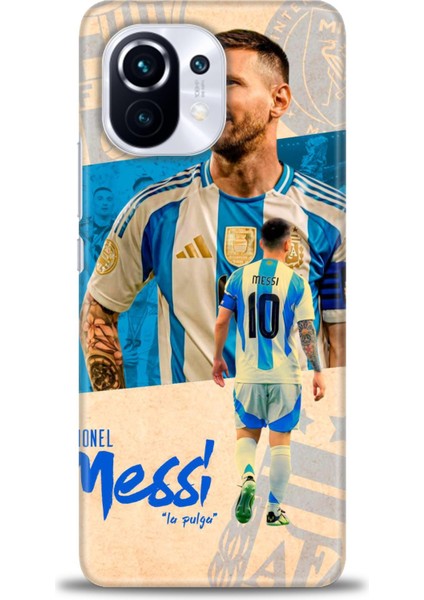 Xiaomi Mi 11 Kılıf Hd Baskılı Kılıf + Seramik Tam Kaplayan Ekran Koruyucu 20