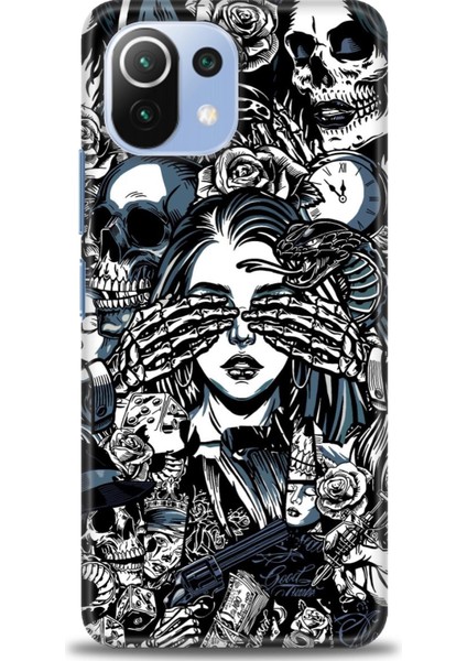 Xiaomi Mi 11 Lite Kılıf Hd Baskılı Kılıf + Seramik Tam Kaplayan Ekran Koruyucu 352