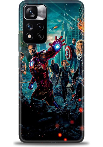 Xiaomi Redmi Note 11 Pro Plus Hd Baskılı Kılıf + Seramik Tam Kaplayan Ekran Koruyucu 100