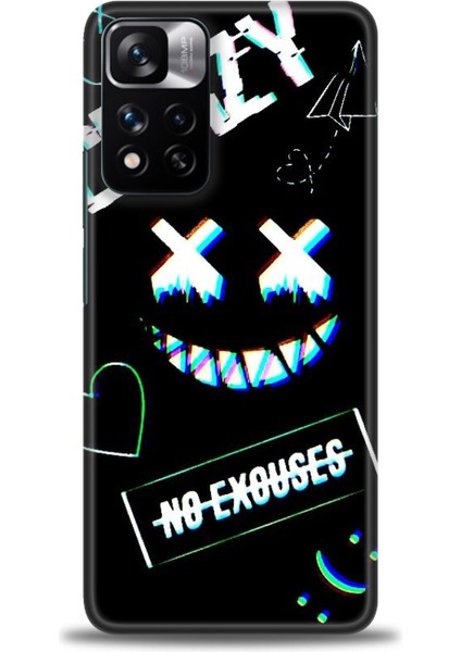 Xiaomi Redmi Note 11 Pro Plus Hd Baskılı Kılıf + Seramik Tam Kaplayan Ekran Koruyucu 356