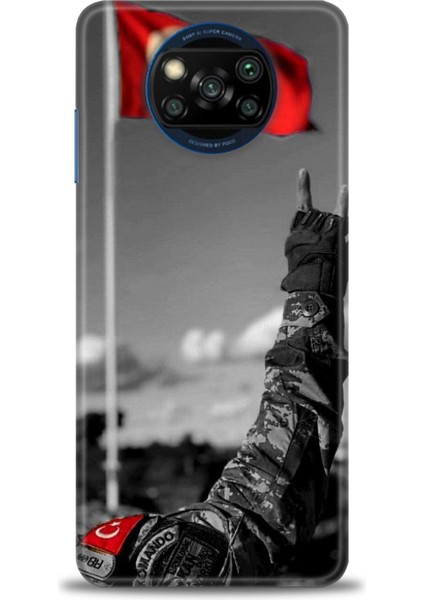 Xiaomi Poco X3 Pro Kılıf Hd Baskılı Kılıf + Seramik Tam Kaplayan Ekran Koruyucu 35