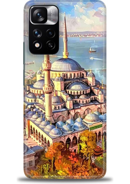 Xiaomi Redmi Note 11 Pro Plus Hd Baskılı Kılıf + Seramik Tam Kaplayan Ekran Koruyucu 226