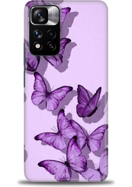 Xiaomi Redmi Note 11 Pro Plus Hd Baskılı Kılıf + Seramik Tam Kaplayan Ekran Koruyucu 300