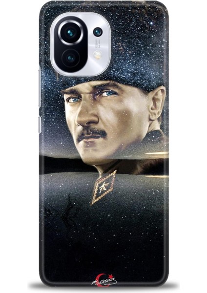 Xiaomi Mi 11 Kılıf Hd Baskılı Kılıf + Seramik Tam Kaplayan Ekran Koruyucu 24