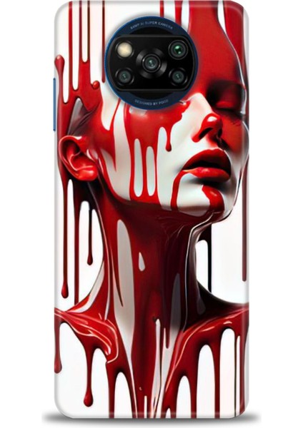 Xiaomi Poco X3 Pro Kılıf Hd Baskılı Kılıf + Seramik Tam Kaplayan Ekran Koruyucu 150