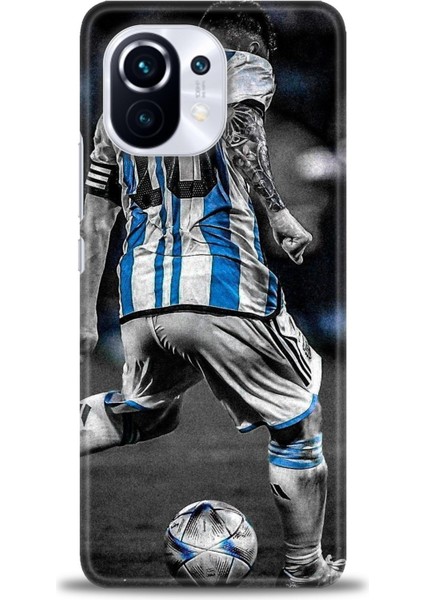 Xiaomi Mi 11 Kılıf Hd Baskılı Kılıf + Seramik Tam Kaplayan Ekran Koruyucu 11