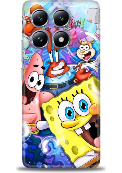 Xiaomi Mi 14T Pro Kılıf Hd Baskılı Kılıf + Seramik Tam Kaplayan Ekran Koruyucu 455