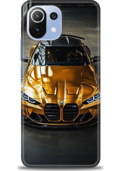 Xiaomi Mi 11 Lite Kılıf Hd Baskılı Kılıf + Seramik Tam Kaplayan Ekran Koruyucu 489