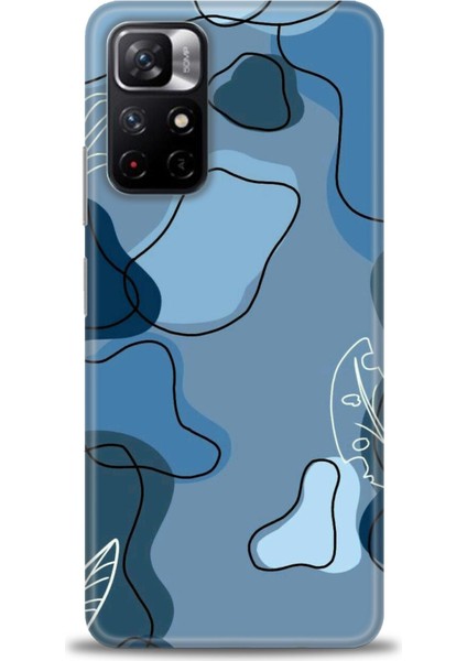 Xiaomi Redmi Note 11 Hd Baskılı Kılıf + Seramik Tam Kaplayan Ekran Koruyucu 172