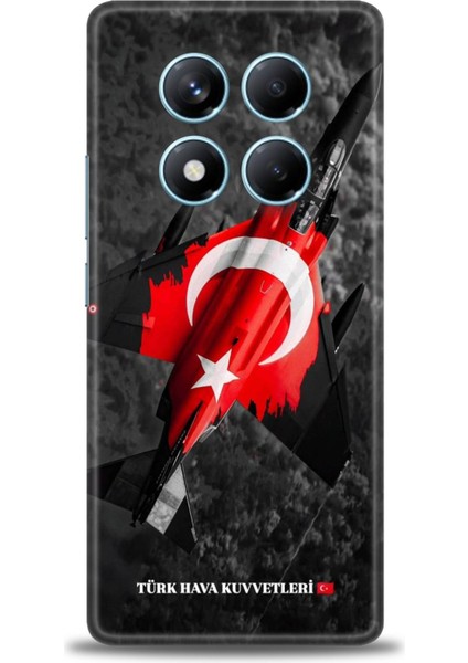 Xiaomi Redmi Note 14 Pro 4g Hd Baskılı Kılıf + Seramik Tam Kaplayan Ekran Koruyucu 37