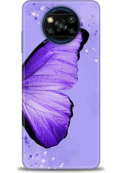 Xiaomi Poco X3 Pro Kılıf Hd Baskılı Kılıf + Seramik Tam Kaplayan Ekran Koruyucu 299