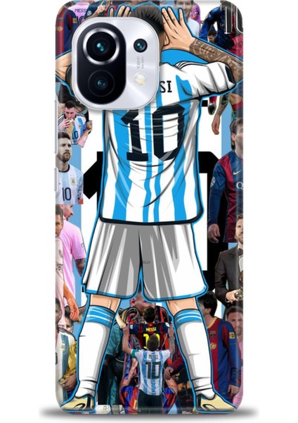 Xiaomi Mi 11 Kılıf Hd Baskılı Kılıf + Seramik Tam Kaplayan Ekran Koruyucu 17