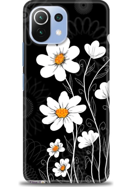 Xiaomi Mi 11 Lite Kılıf Hd Baskılı Kılıf + Seramik Tam Kaplayan Ekran Koruyucu 133