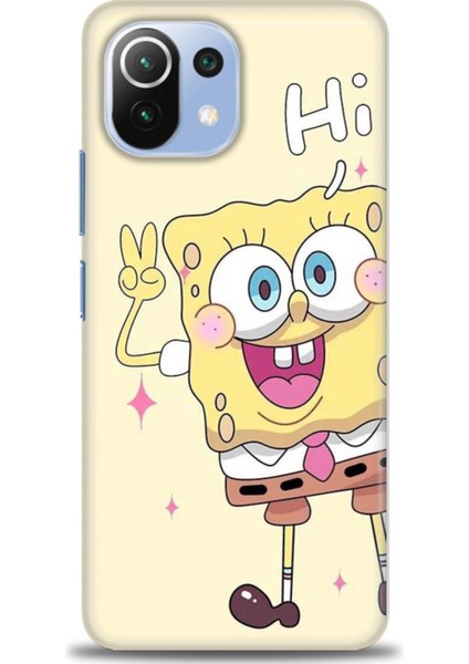 Xiaomi Mi 11 Lite Kılıf Hd Baskılı Kılıf + Seramik Tam Kaplayan Ekran Koruyucu 457