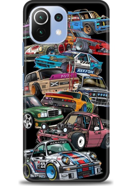 Xiaomi Mi 11 Lite Kılıf Hd Baskılı Kılıf + Seramik Tam Kaplayan Ekran Koruyucu 481