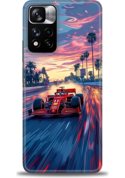Xiaomi Redmi Note 11 Pro Plus Hd Baskılı Kılıf + Seramik Tam Kaplayan Ekran Koruyucu 102