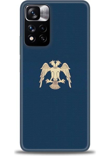 Xiaomi Redmi Note 11 Pro Plus Hd Baskılı Kılıf + Seramik Tam Kaplayan Ekran Koruyucu 470