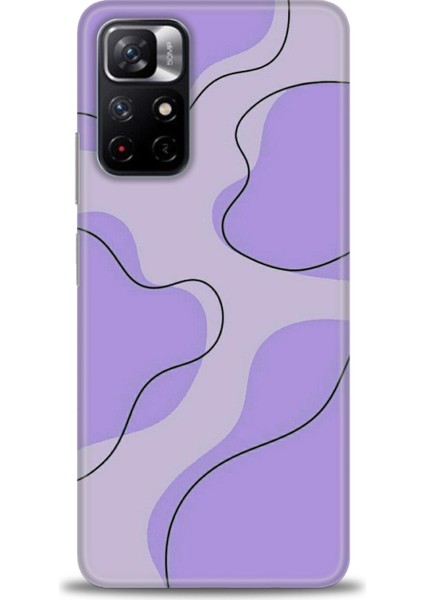 Xiaomi Redmi Note 11 Hd Baskılı Kılıf + Seramik Tam Kaplayan Ekran Koruyucu 176