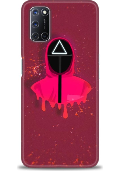 Oppo A92 Kılıf Hd Baskılı Kılıf + Seramik Tam Kaplayan Ekran Koruyucu 287